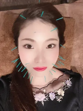 メンズ 美容鍼灸サロン LOMIHARIのエステ・リラクイメージ