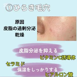 愛維美水光美肌専門店 メンズレディースokのエステ・リラクイメージ