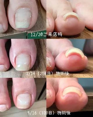 ネイル 【まみ】 Ka Pilinaのネイルデザイン