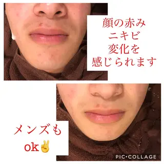 セミロング カラー パーマ ヘアアレンジ メンズ キッズ ネイル マツエク・マツパ 金の糸脱毛 産毛ケア専門のエステ・リラクイメージ