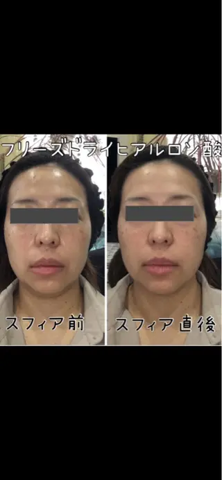 脱毛＆美肌 おざわまいのエステ・リラクイメージ