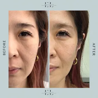 White labo 須谷のエステ・リラクイメージ