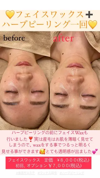 メンズ Salon de Lino 御器所のエステ・リラクイメージ