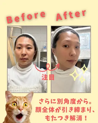 セルフ脱毛・光エステ LISALISAのエステ・リラクイメージ