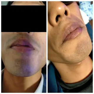 メンズ jonny's beautyのエステ・リラクイメージ
