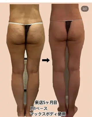 asmy 西梅田店のエステ・リラクイメージ