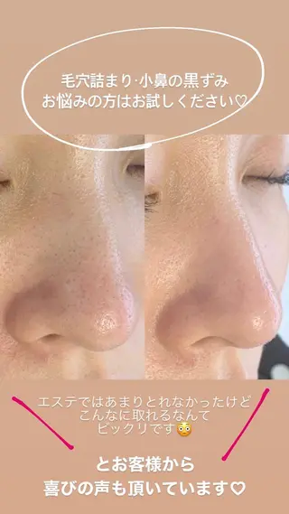 メンズ 稲嶺 美華のエステ・リラクイメージ