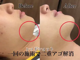六本木脱毛andS Saoriのエステ・リラクイメージ