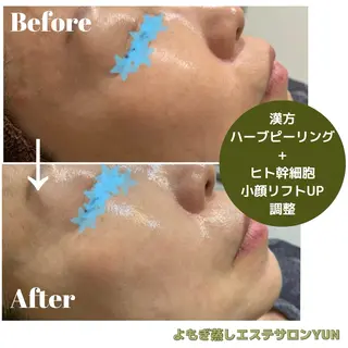 よもぎ蒸しサロン ゆんのエステ・リラクイメージ