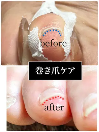 ネイル 東京あきる野市ネイル ✿ ｙｕiのネイルデザイン
