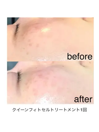 浜野 恵美のエステ・リラクイメージ