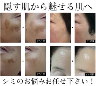 寝る前に通える肌改善 専門サロンyuccaのエステ・リラクイメージ