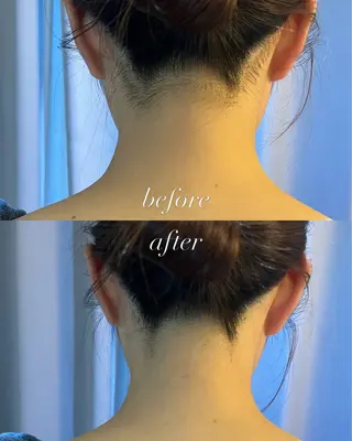 ネイル うなじ脱毛/美肌脱毛 LABELのエステ・リラクイメージ