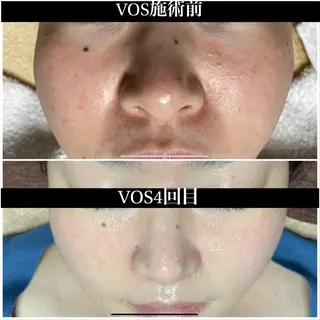 代表 MOMOのエステ・リラクイメージ