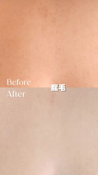 豊橋 |Hitomi シュガーリング専門店のその他イメージ