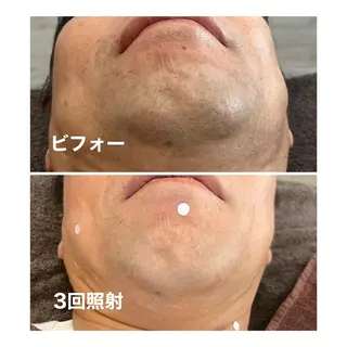脱毛 yukinoのエステ・リラクイメージ