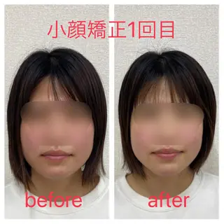 小顔矯正サロン Lilyのエステ・リラクイメージ