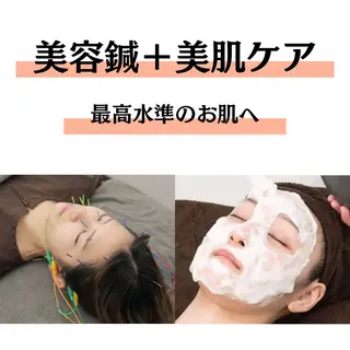 ハリサロンドオフ 美容鍼灸×小顔整体のエステ・リラクイメージ