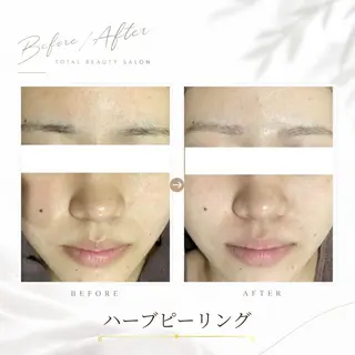《 肌質×美肌 》 addissimoのエステ・リラクイメージ
