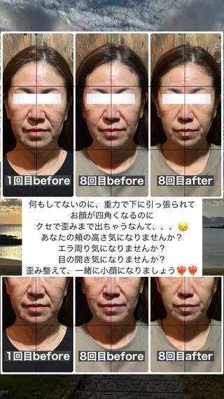 💎後悔させない小顔 矯正💎イトヤマ🌱のエステ・リラクイメージ