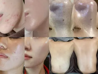 艶肌デトックス🫧 Samiraのエステ・リラクイメージ