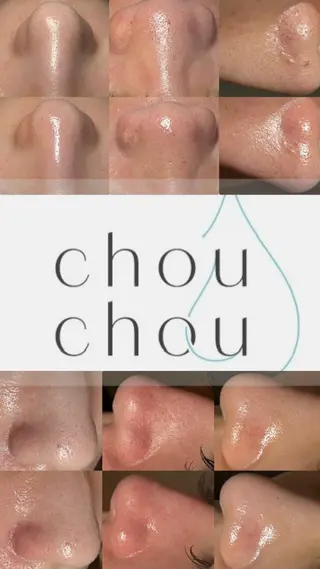 トータルボディケア chouchouのその他イメージ