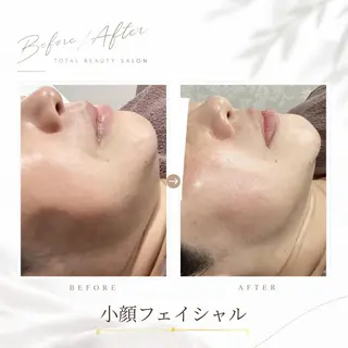 《 肌質×美肌 》 addissimoのエステ・リラクイメージ