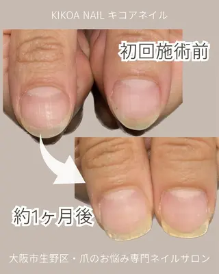 ネイル KIKOA NAIL キコアネイルのネイルデザイン