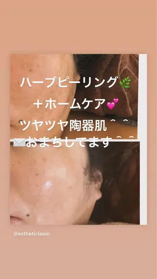 ❤️予約殺到❤️mi オールハンド痩身専門のエステ・リラクイメージ
