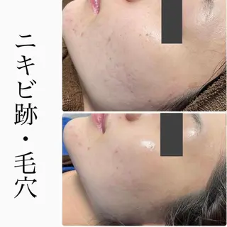 ハーブピーリング専門 BIOPLUS+川崎のエステ・リラクイメージ