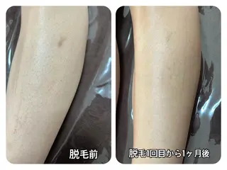 ÉMIA ✴︎のエステ・リラクイメージ