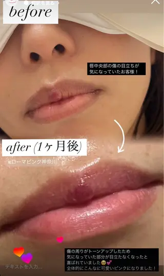 【ローマピンク施術】 Kaoのその他イメージ