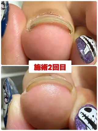 ネイル -TOIRO- Eriのネイルデザイン