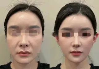 ネイル 愛維美水光専門店 川崎彩鳳のエステ・リラクイメージ