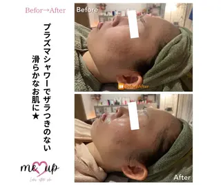 Meupニキビ専門店 背中/ハーブ/肌管理のその他イメージ