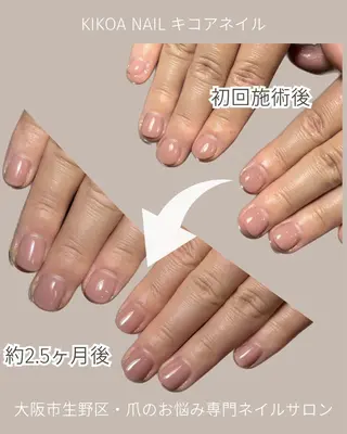 ネイル KIKOA NAIL キコアネイルのネイルデザイン