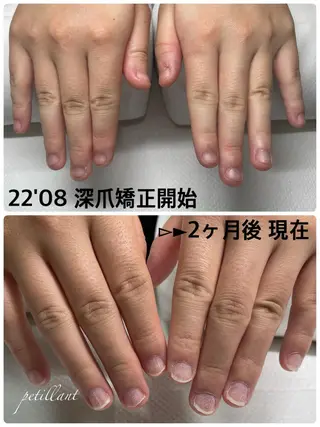 ネイル nail salon petillantのネイルデザイン