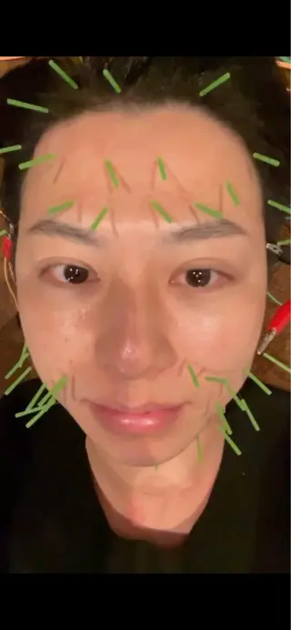 美容鍼灸サロン LOMIHARIのエステ・リラクイメージ