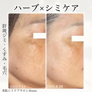美肌シミケアサロン 4tune.RUMIのその他イメージ
