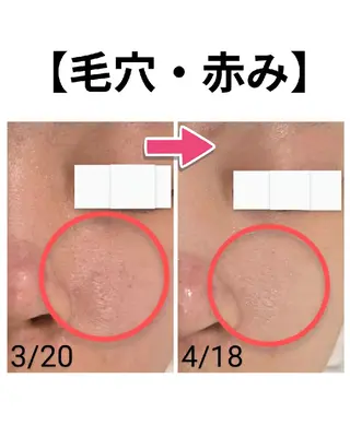 上尾Luce. あきやまのエステ・リラクイメージ