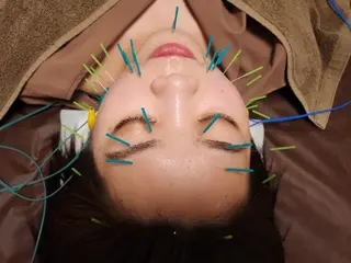 即効⚡小顔美容鍼🪡 むくみたるみケア鍼!のエステ・リラクイメージ