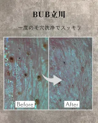 メンズ 【BUB立川】 ゆかのエステ・リラクイメージ