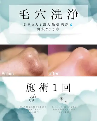 医療提携 肌管理痩身エステ池袋のエステ・リラクイメージ