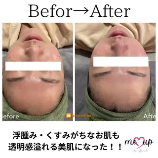 Meupニキビ専門店 背中/ハーブ/肌管理のその他イメージ