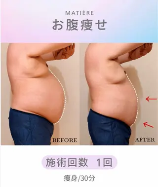 痩身×巡り改善 🌿MATIÈREのエステ・リラクイメージ