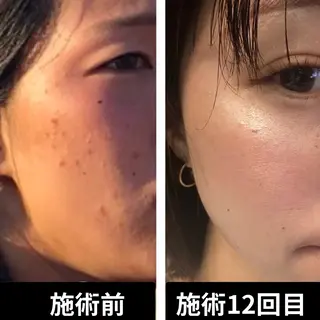 はが ゆかのエステ・リラクイメージ