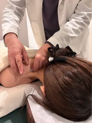 美容鍼/小顔&整体 nano.faceのエステ・リラクイメージ