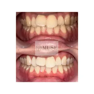 メンズ セルフホワイトニング MUSE🫧焼津のその他イメージ