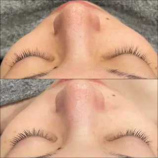 LiZA エステティックサロンのエステ・リラクイメージ