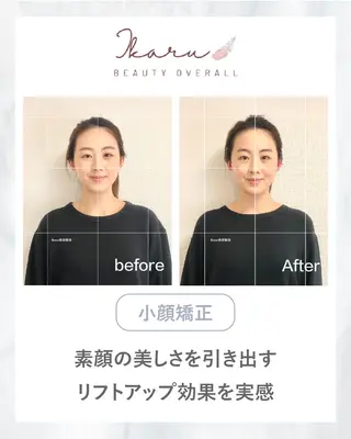ikaru美容整体 池袋のエステ・リラクイメージ